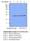 MNSOD / SOD2 Antibody
